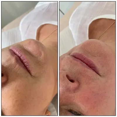 Agnieszka Bonk Kosmetologia Estetyczna